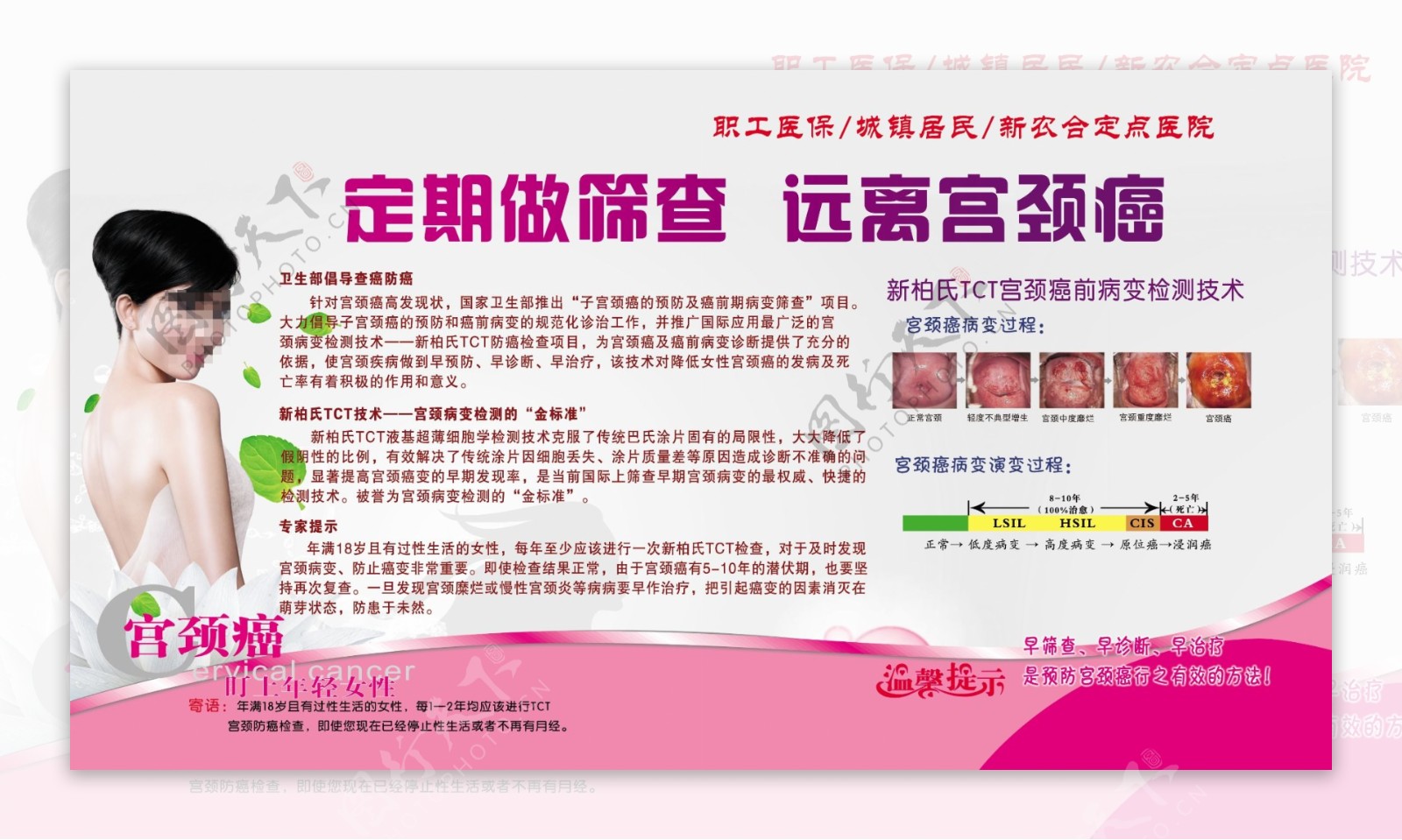 宫颈癌检测技术展板图片