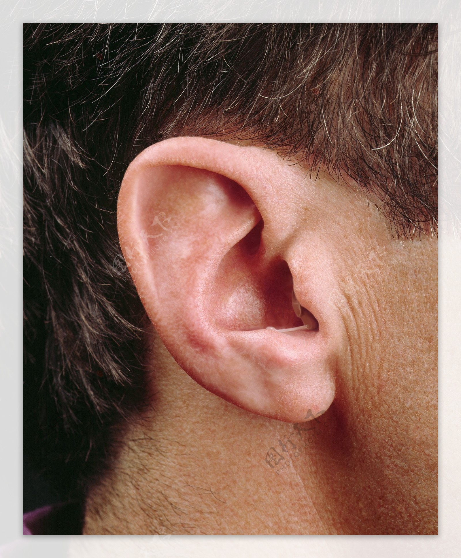 深耳道式助听器外观极隐蔽图片