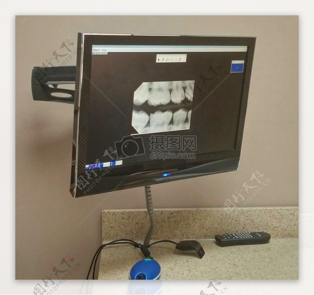 牙科X光片