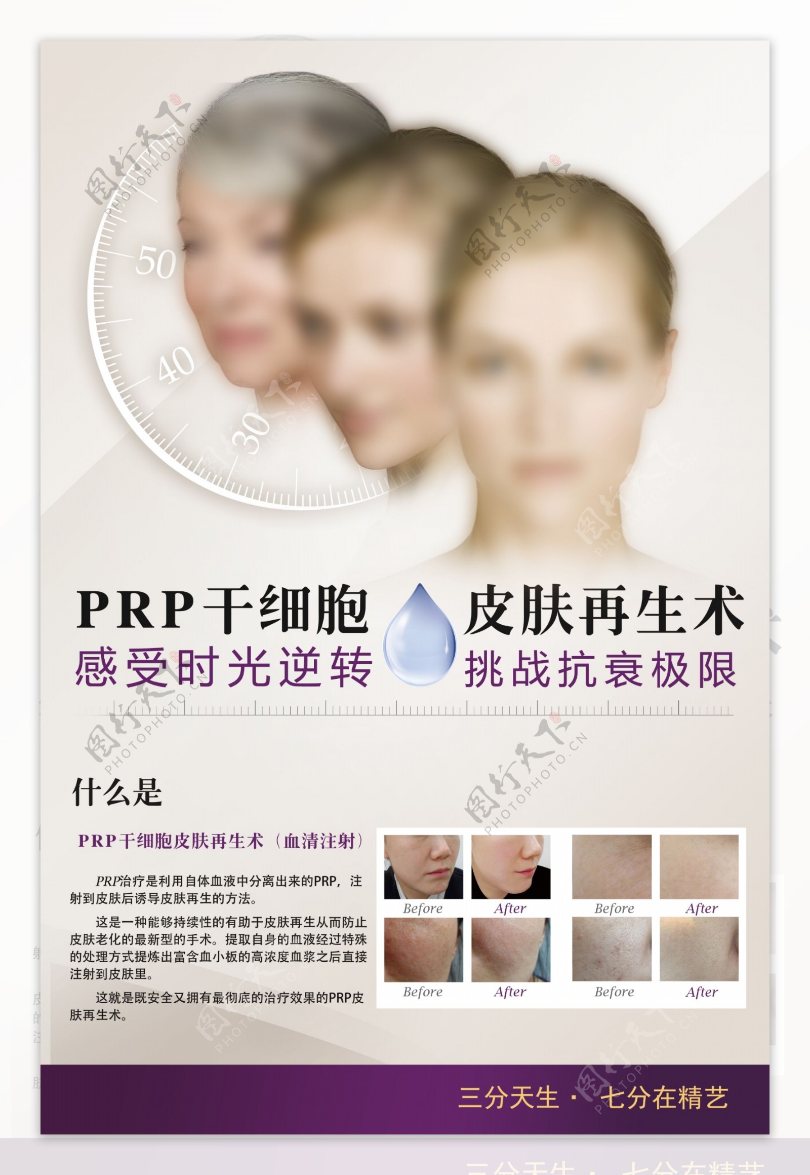 PRP干细胞皮肤再生术由老变年轻