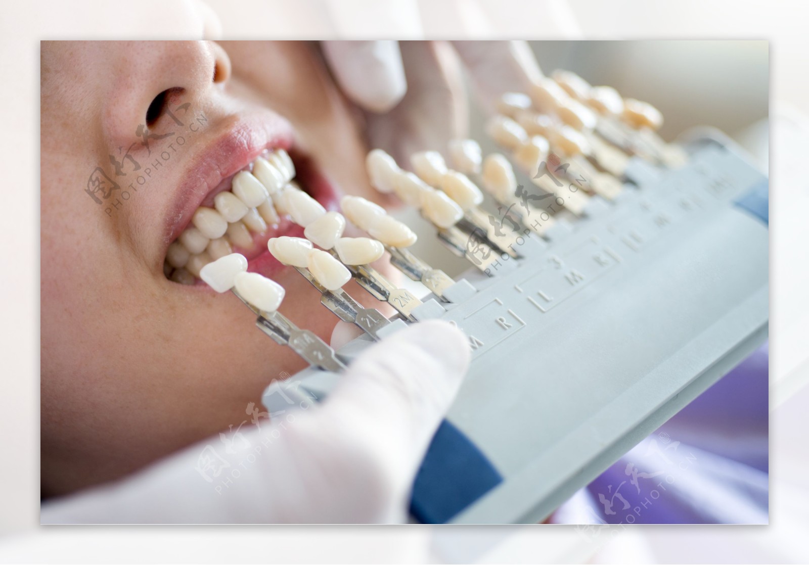 种植牙安全吗？假牙和种植牙有哪些区别，三甲名医为您揭露真相 - 知乎