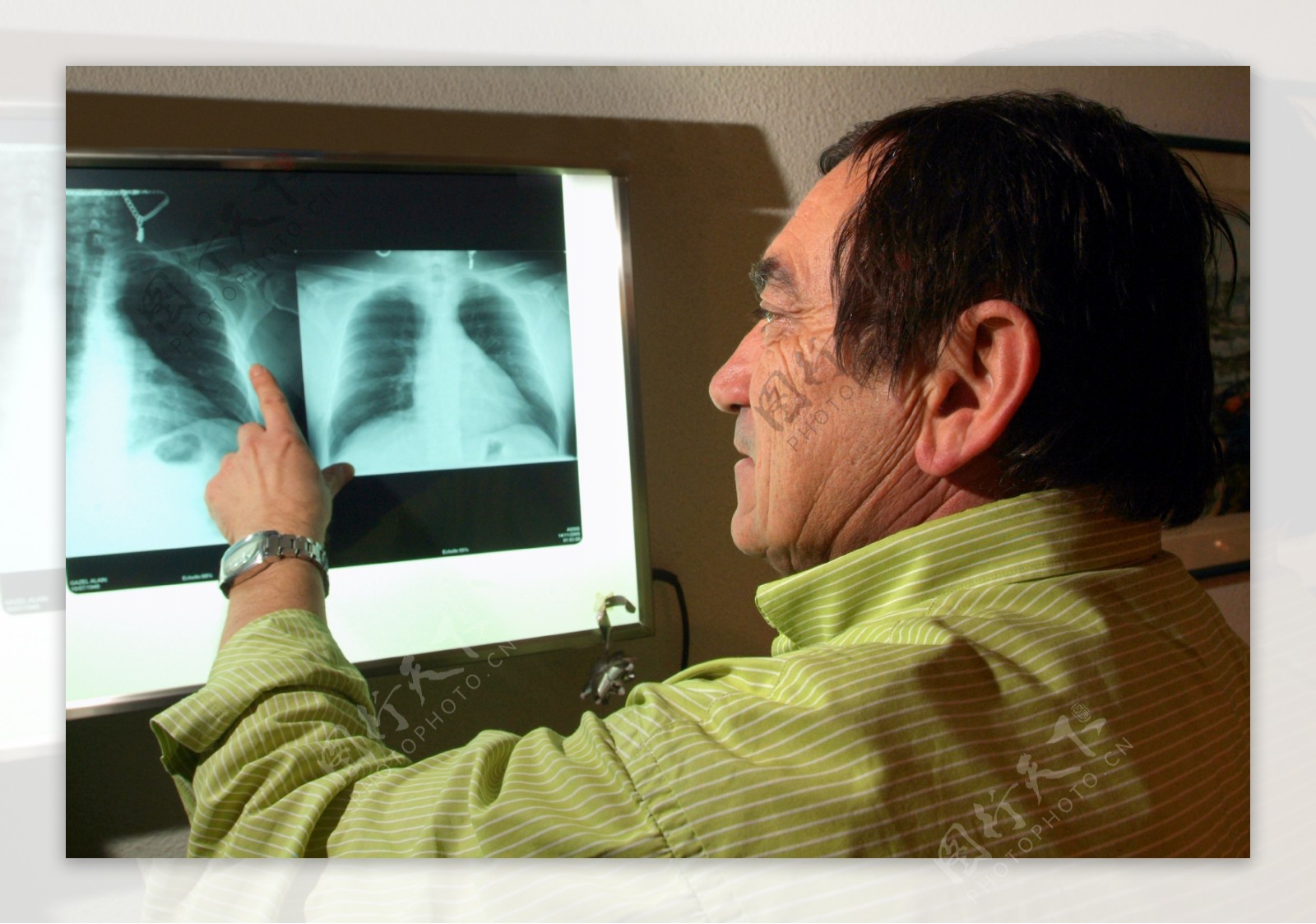 看X光片的医生图片