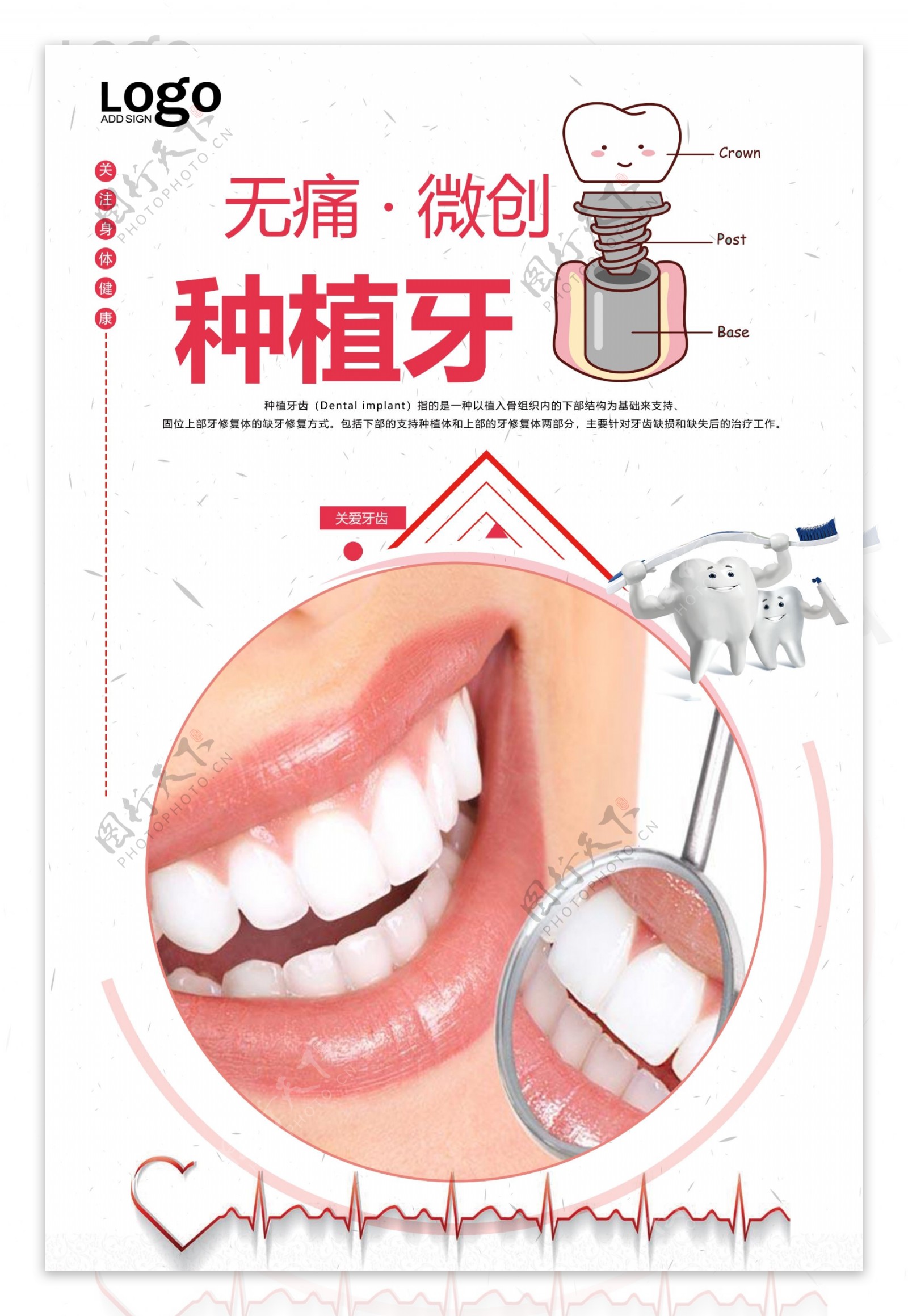 牙齿种植海报设计