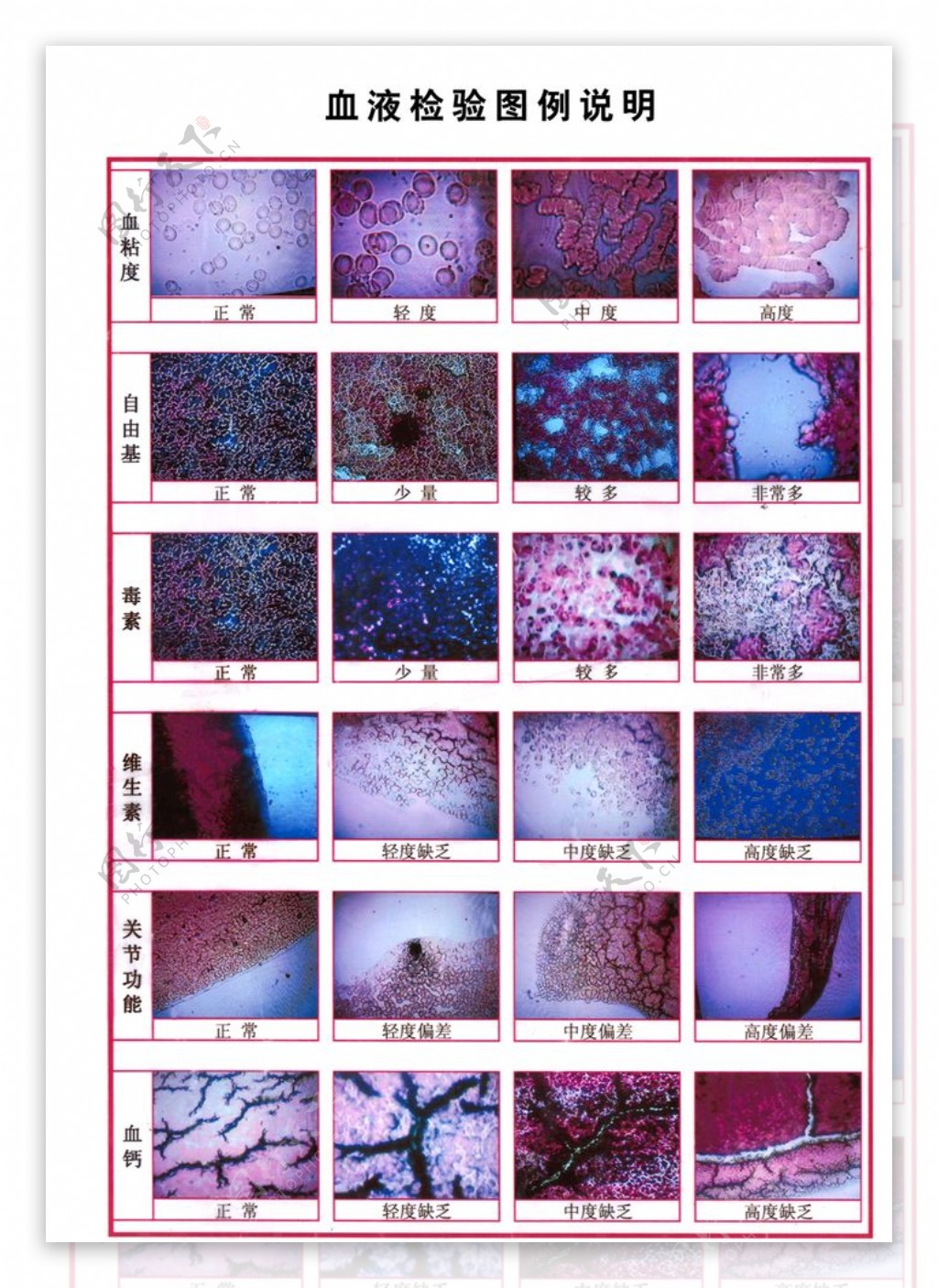 血液检测图例说明